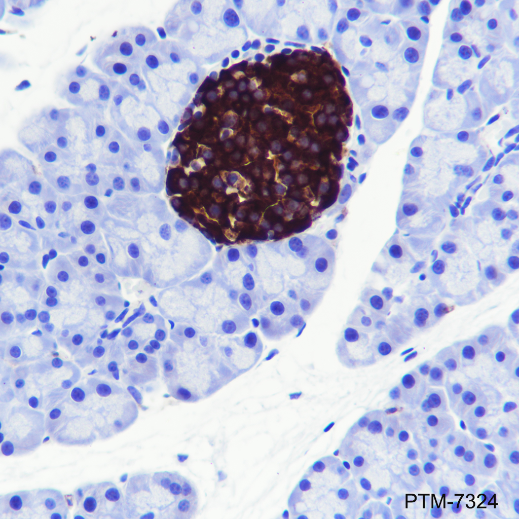Anti-Notch1 Rabbit mAb