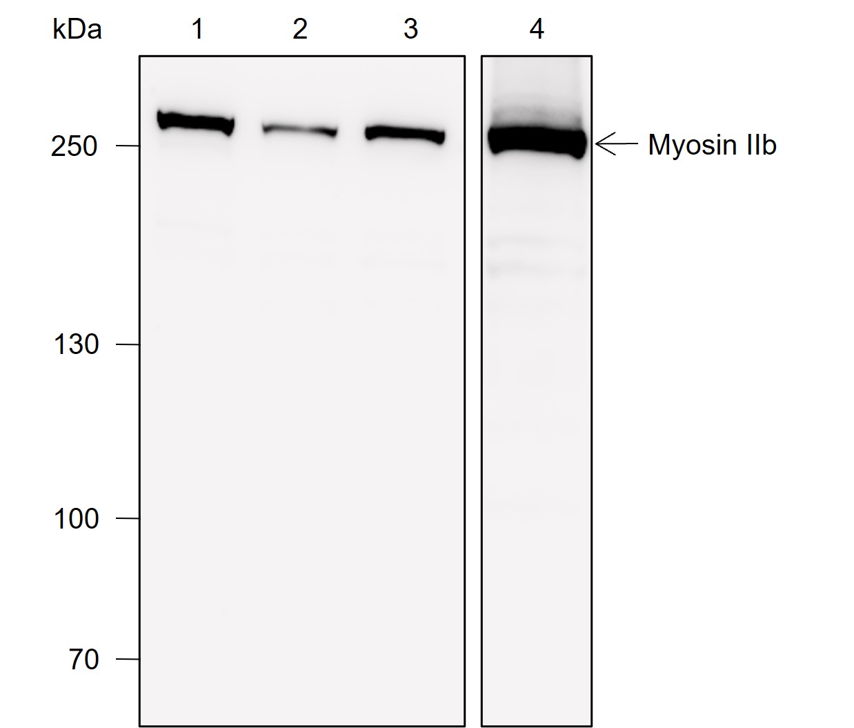 Anti-Myosin IIb Rabbit mAb
