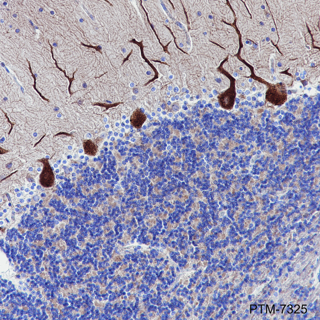 Anti-Myosin IIb Rabbit mAb