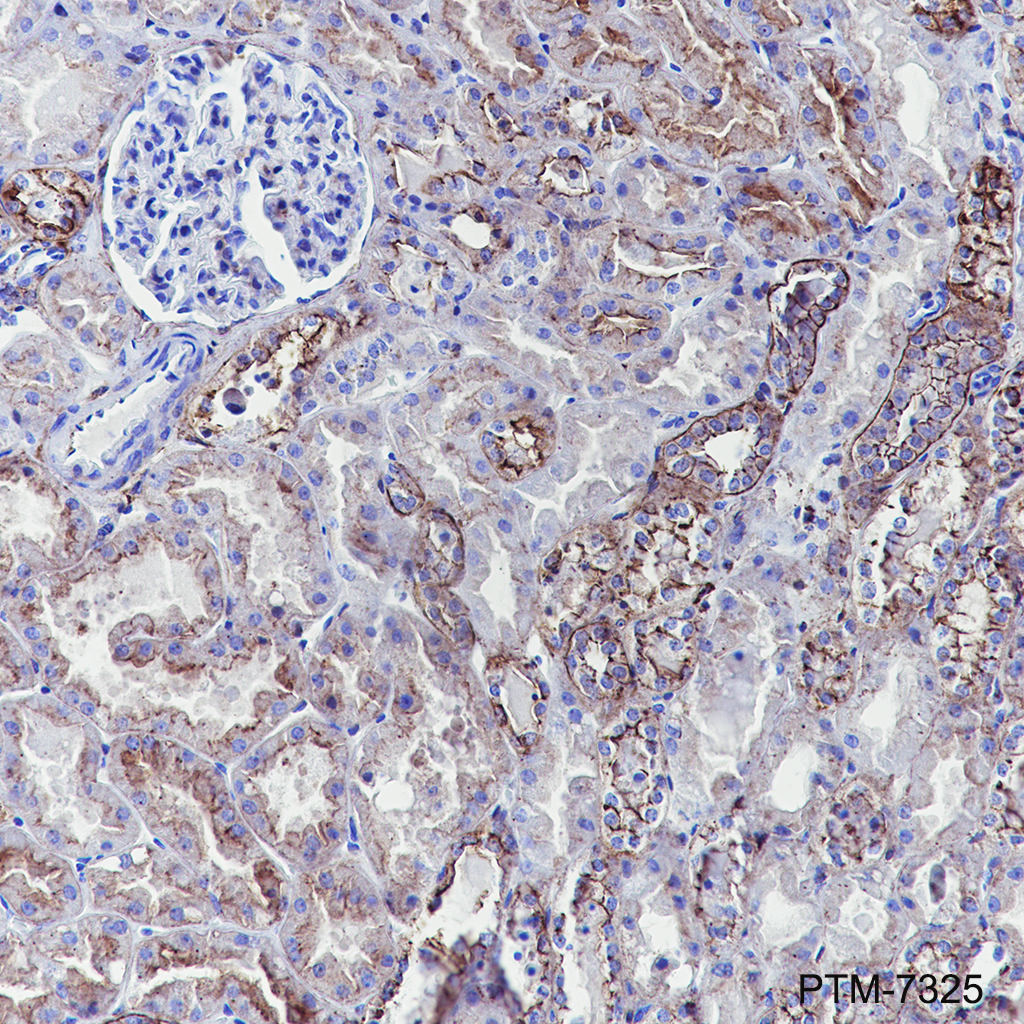 Anti-Myosin IIb Rabbit mAb