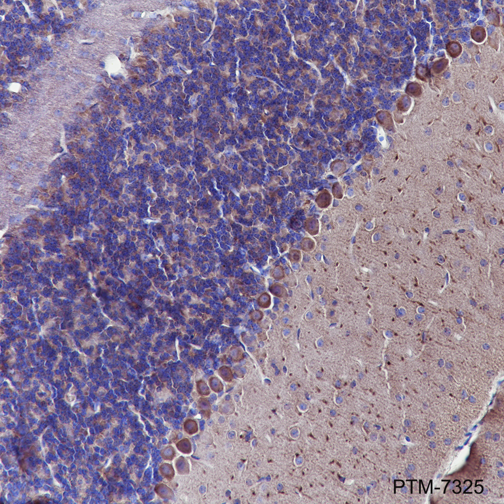 Anti-Myosin IIb Rabbit mAb