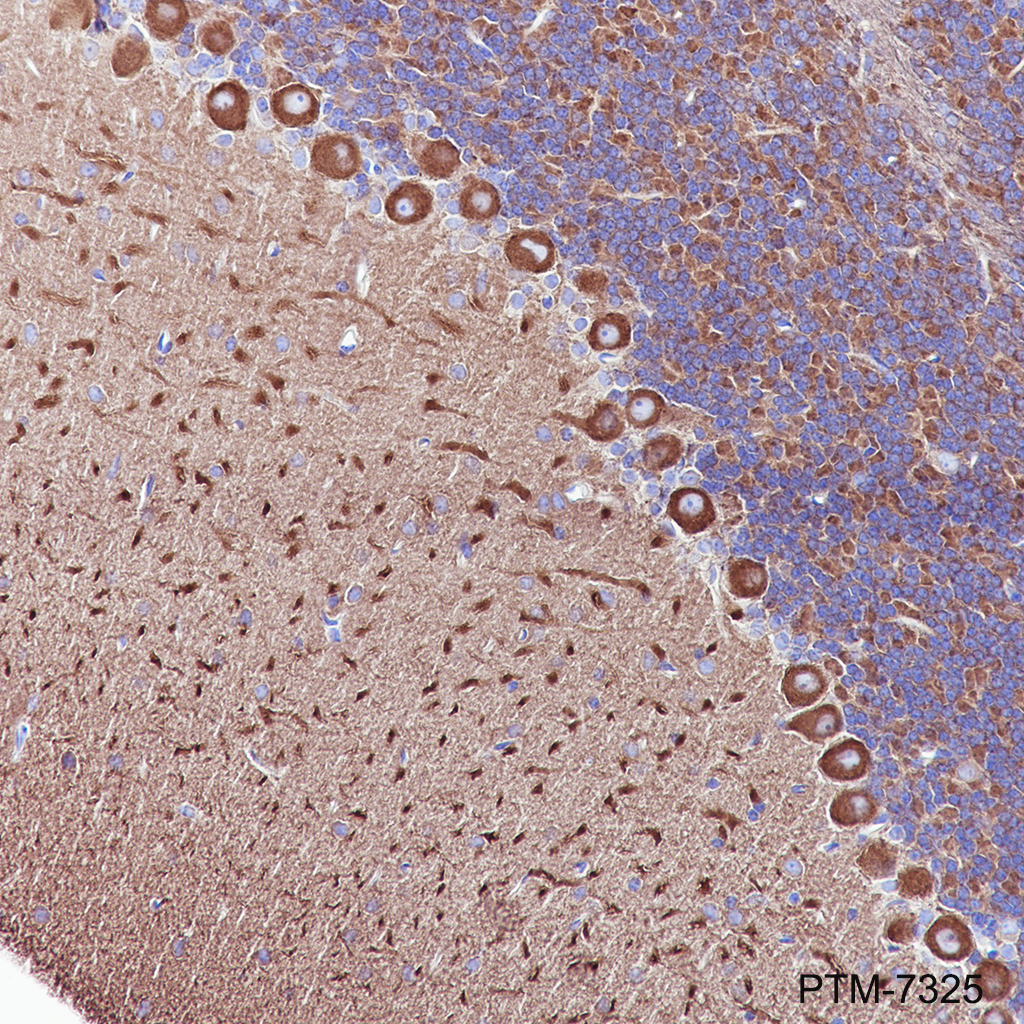 Anti-Myosin IIb Rabbit mAb