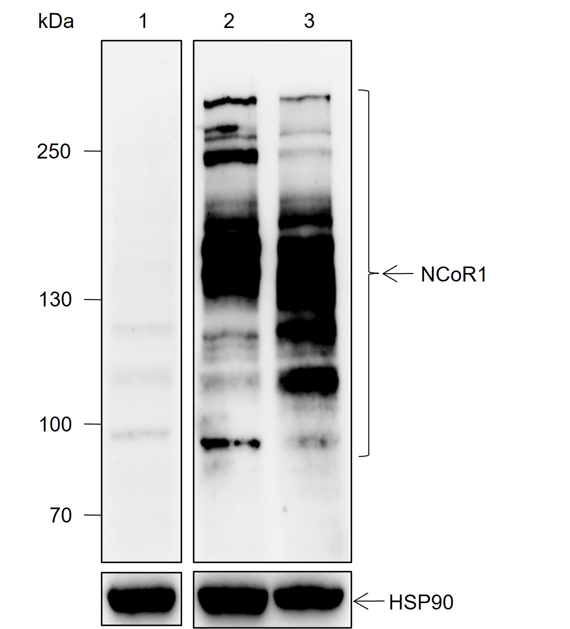 Anti-NCoR1 Rabbit mAb