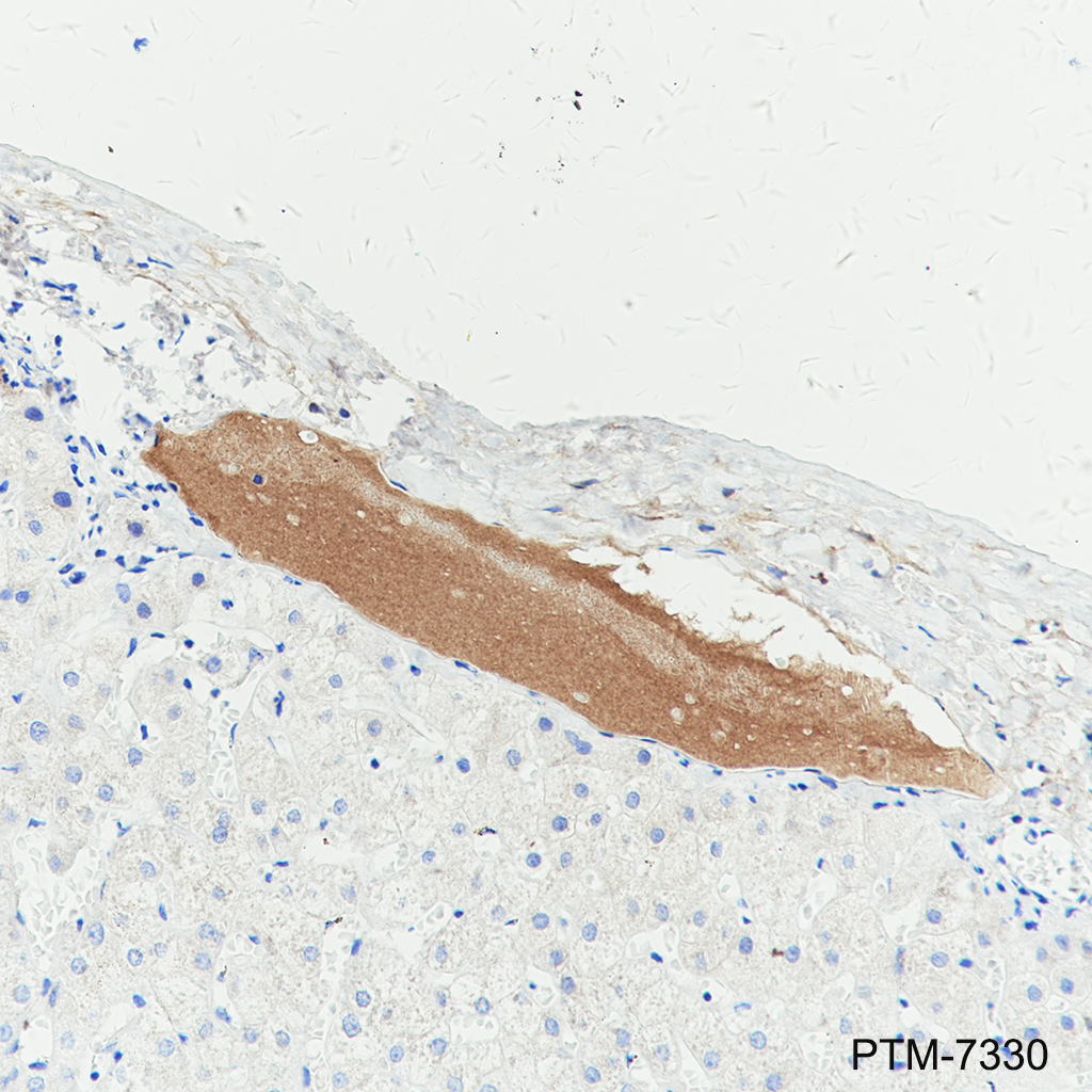 Anti-Complement Factor 8 beta / C8B Rabbit mAb