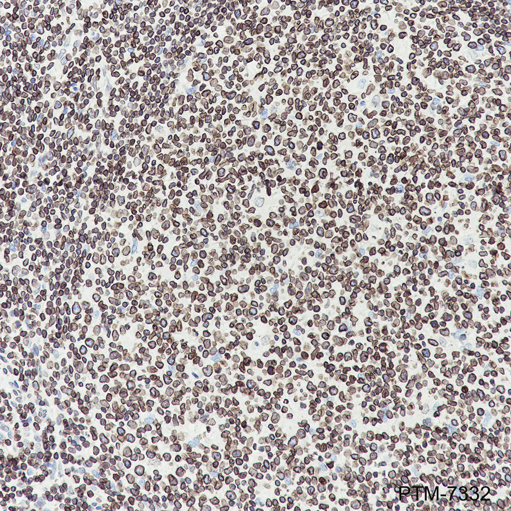 Anti-Lamin B Receptor / LBR Mouse mAb