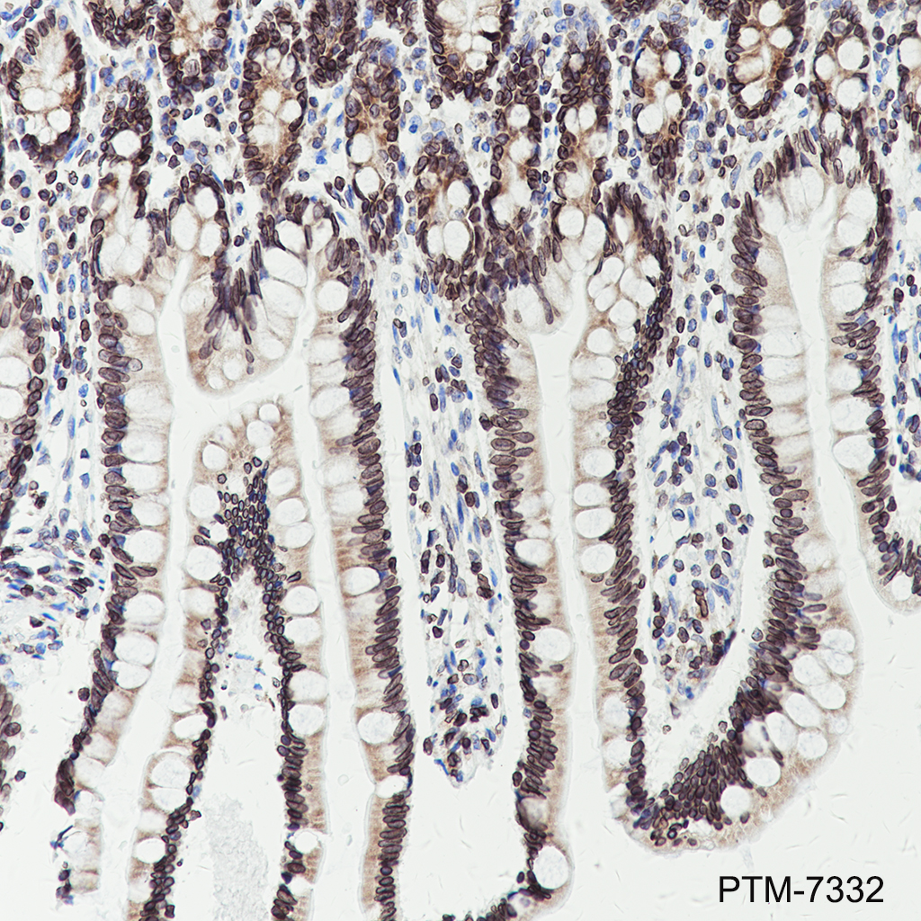 Anti-Lamin B Receptor / LBR Mouse mAb
