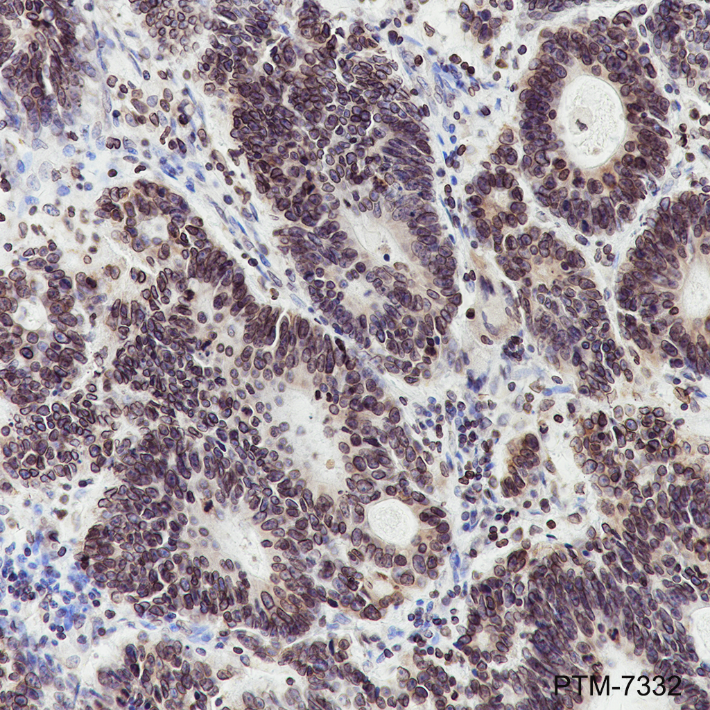 Anti-Lamin B Receptor / LBR Mouse mAb