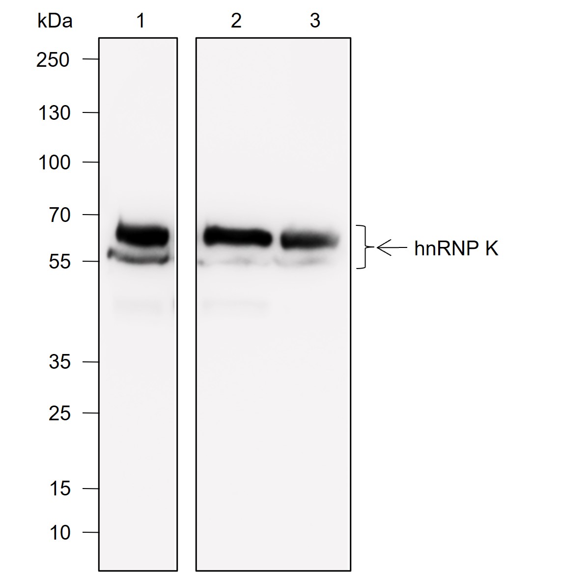 Anti-hnRNP K Mouse mAb