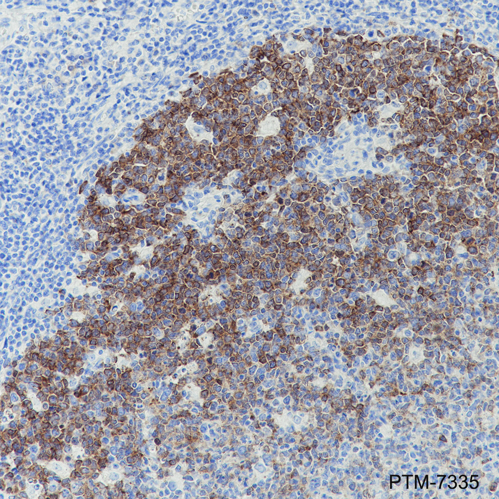 Anti-AID Rabbit mAb