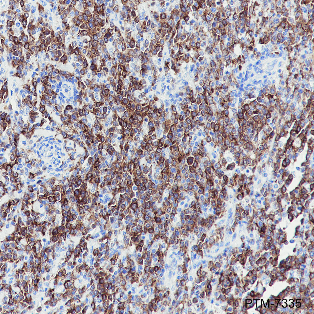Anti-AID Rabbit mAb