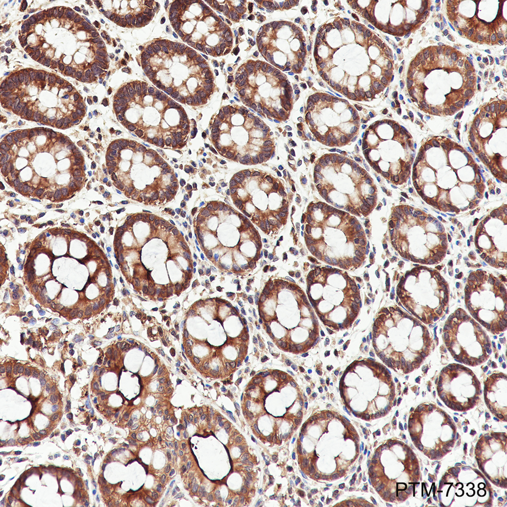 Anti-PRDM4/PFM1 Rabbit mAb