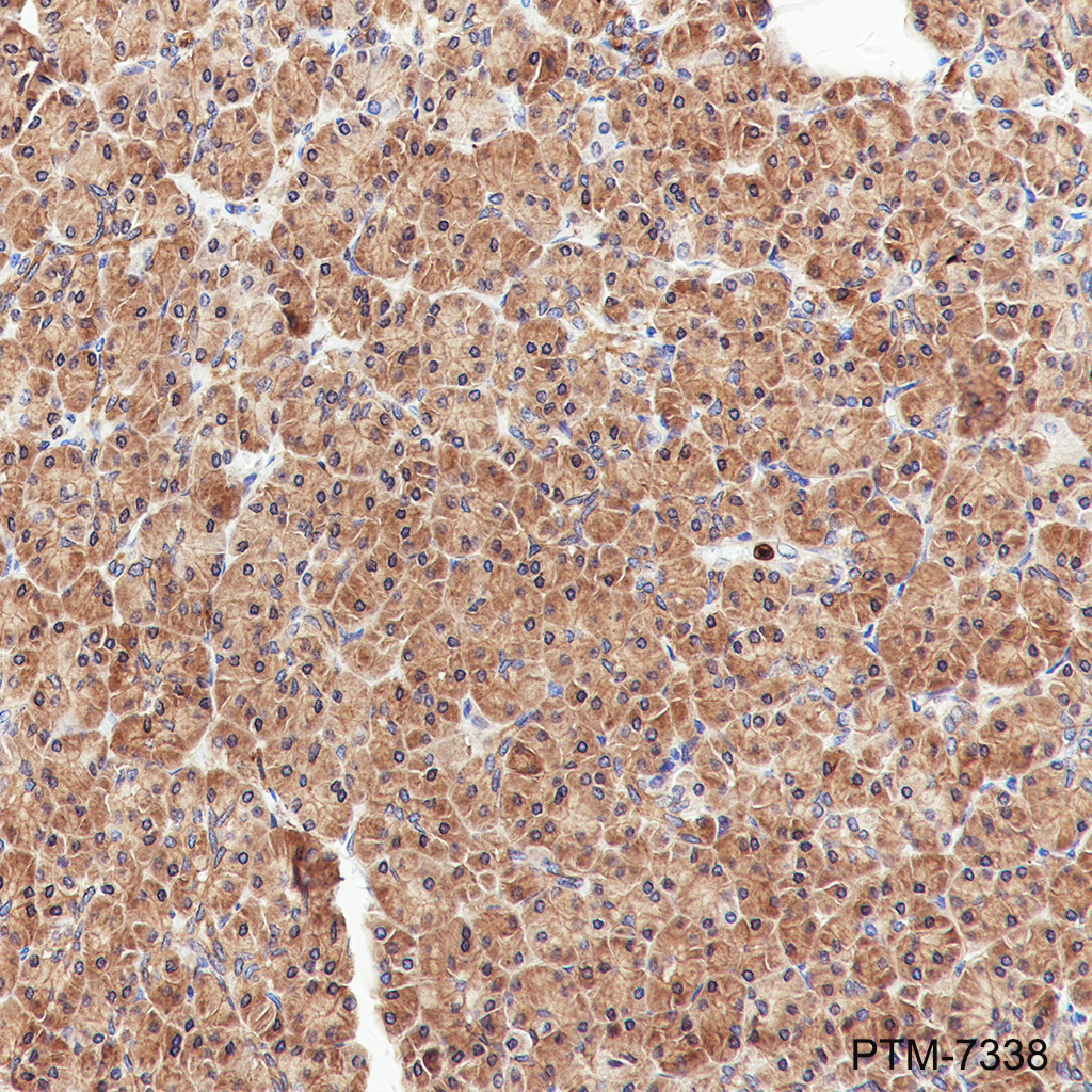 Anti-PRDM4/PFM1 Rabbit mAb