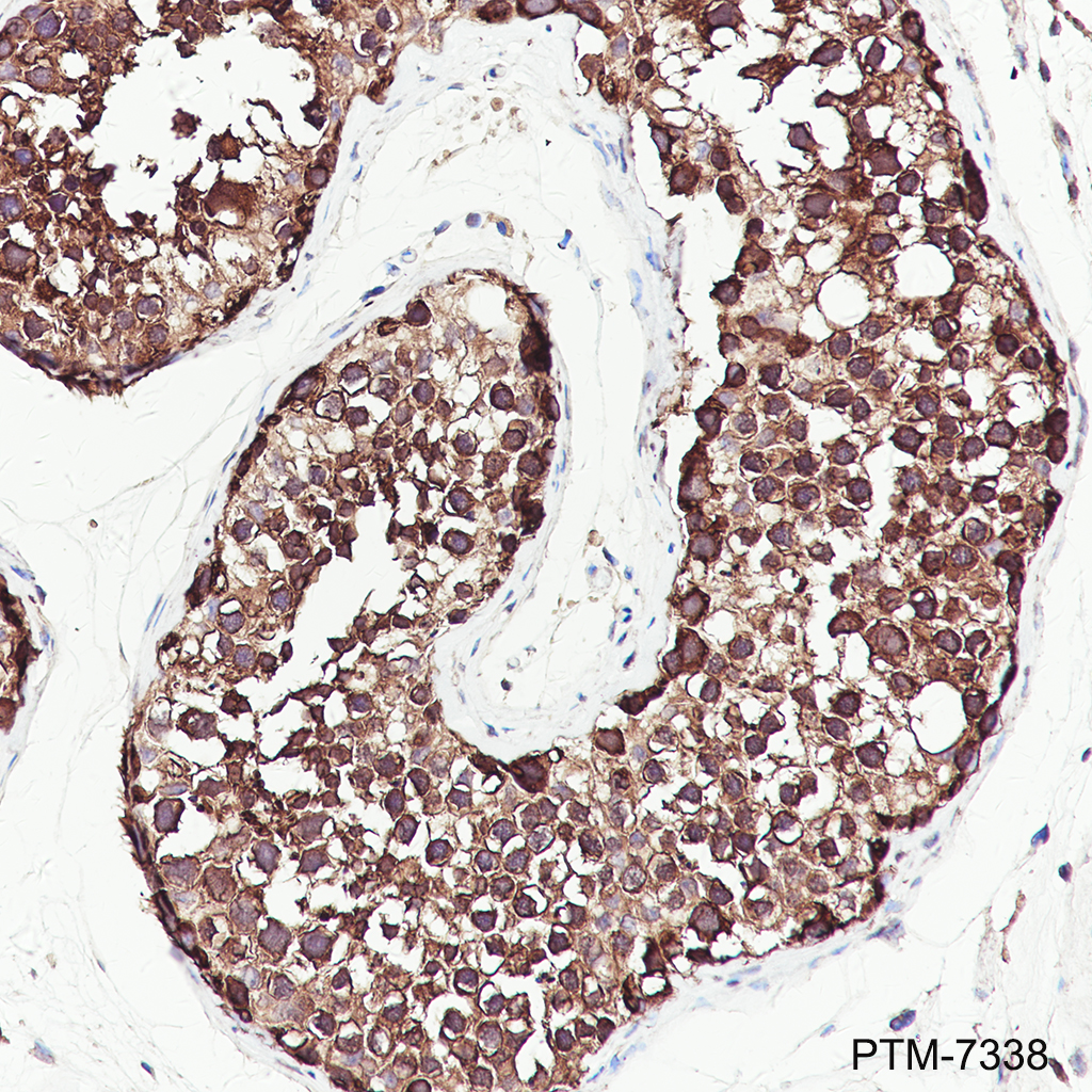 Anti-PRDM4/PFM1 Rabbit mAb