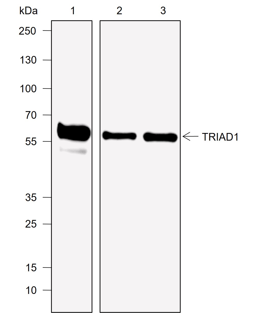 Anti-TRIAD1 Rabbit mAb