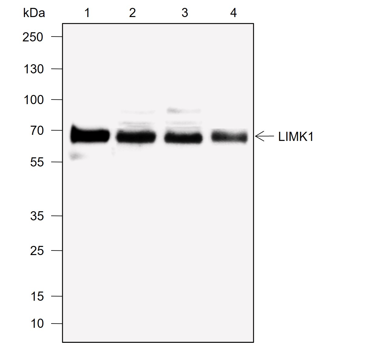 Anti-LIMK1 Rabbit mAb