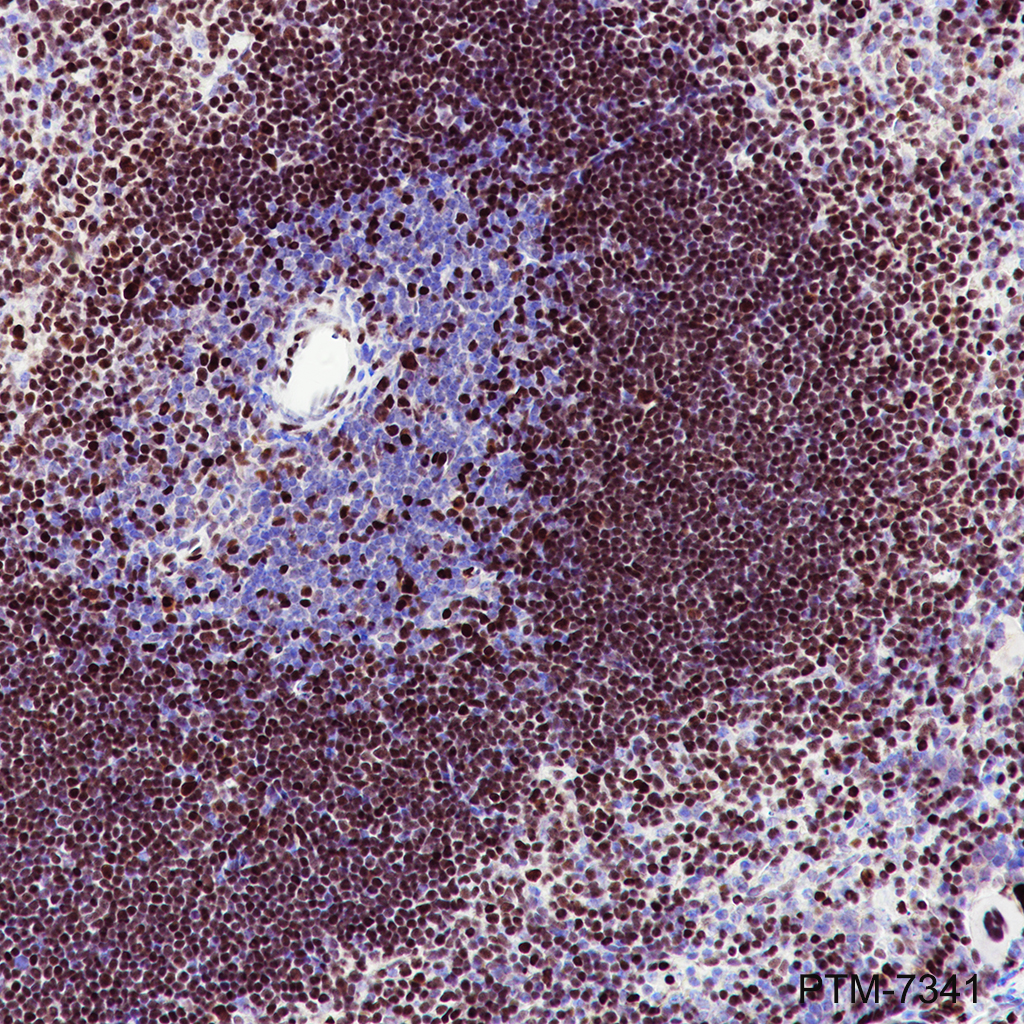 Anti-MEF2C Rabbit mAb