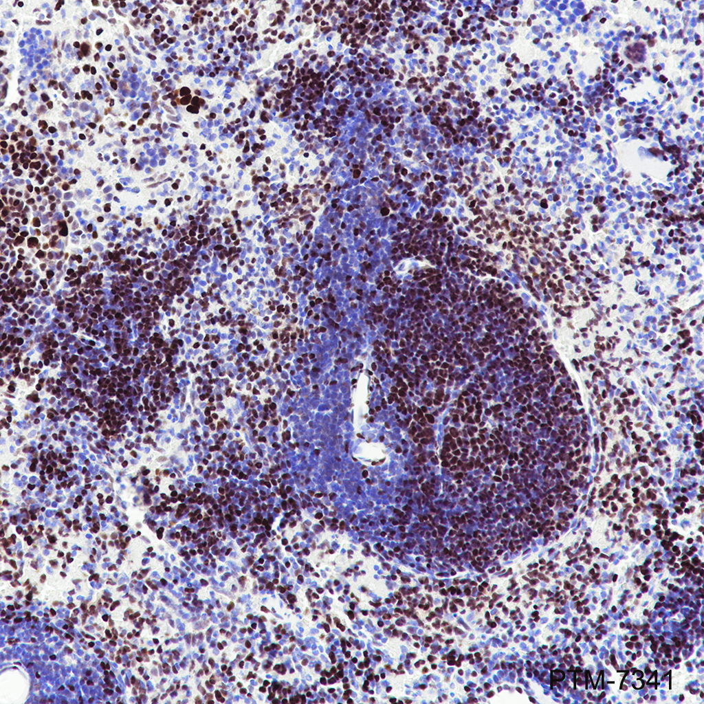 Anti-MEF2C Rabbit mAb