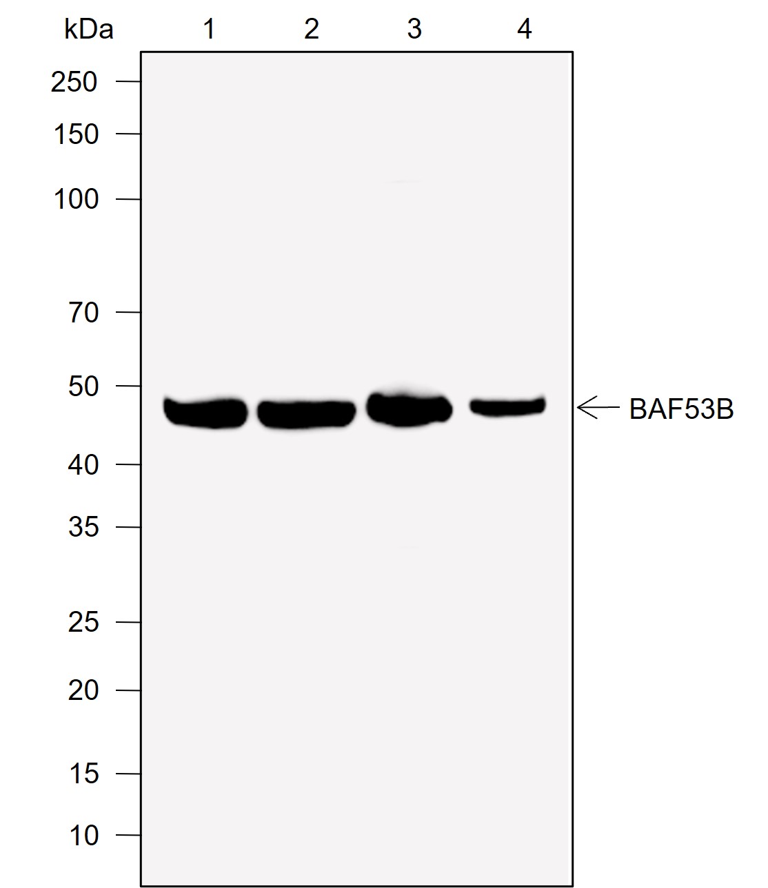 Anti-BAF53B Rabbit mAb