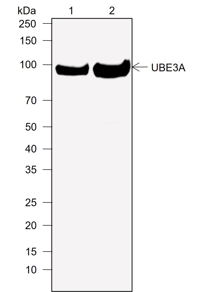 Anti-UBE3A Rabbit mAb