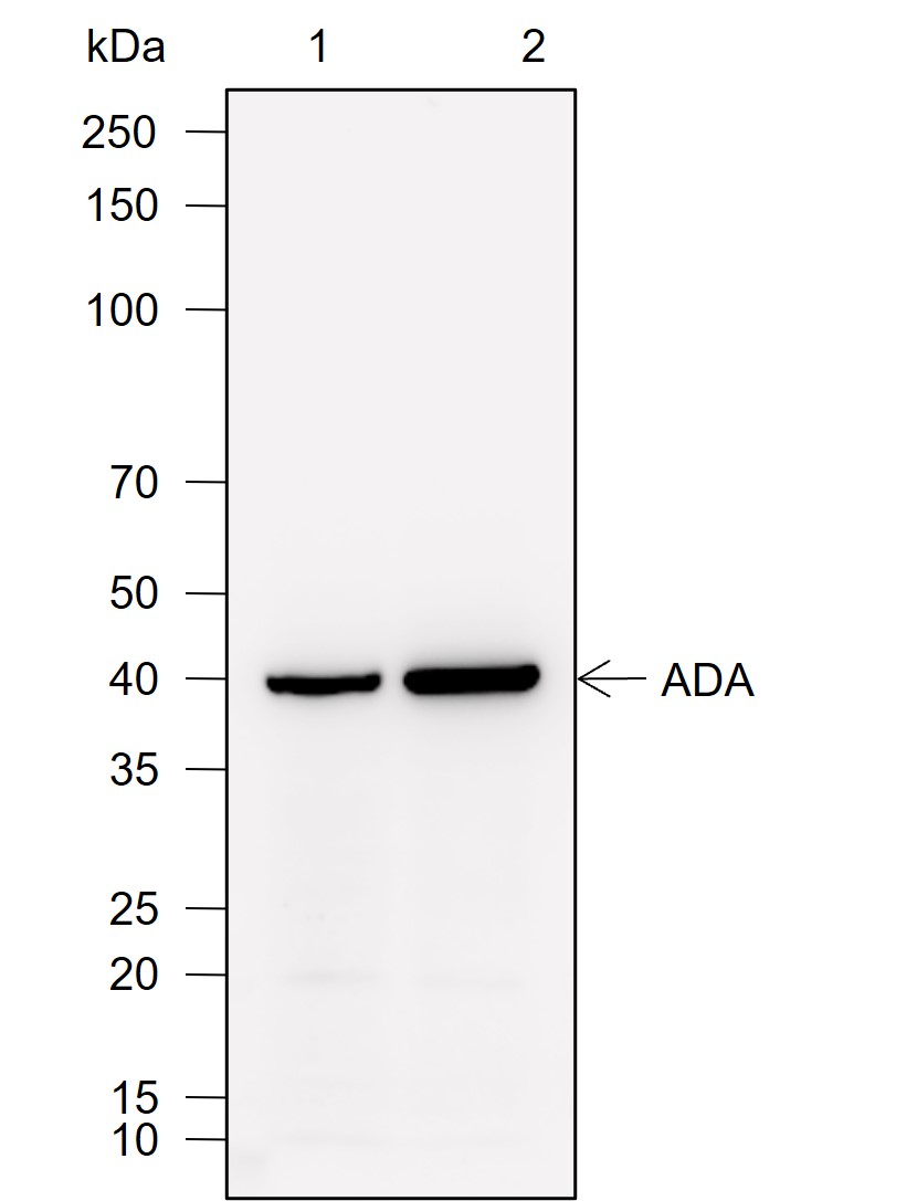 Anti-ADA Rabbit mAb