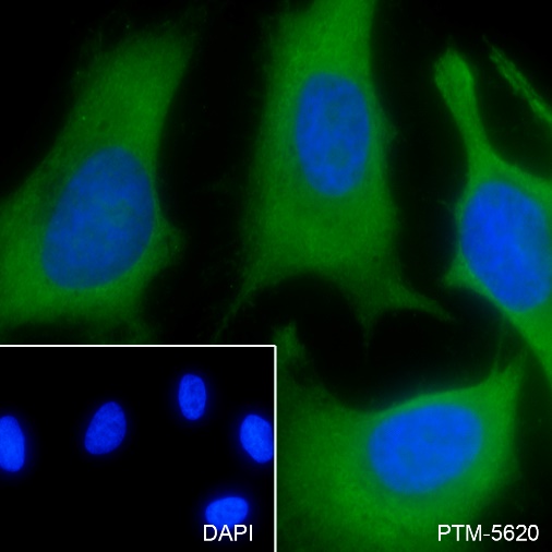 Anti-4E-BP1 Mouse mAb
