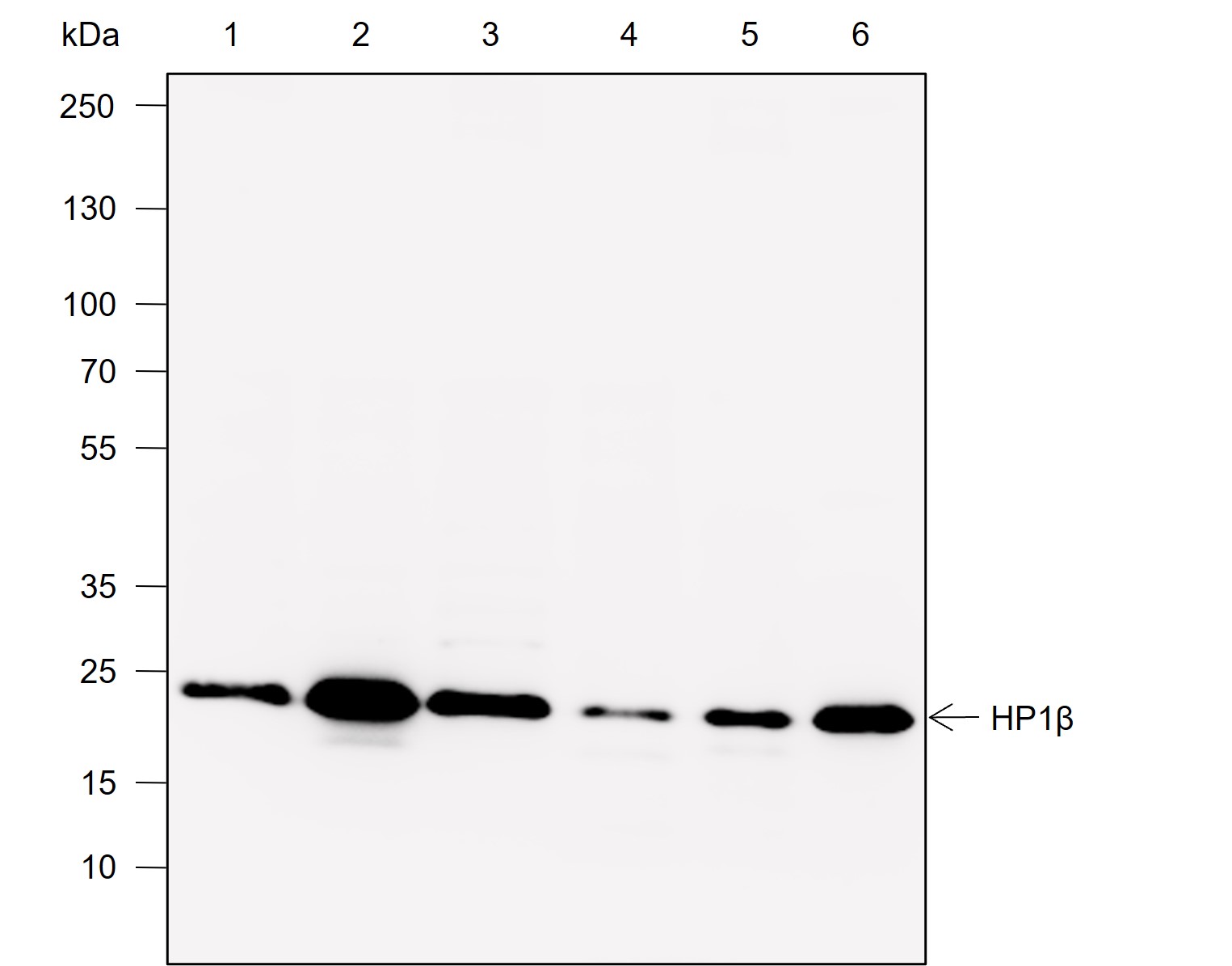 Anti-HP1 beta Rabbit mAb