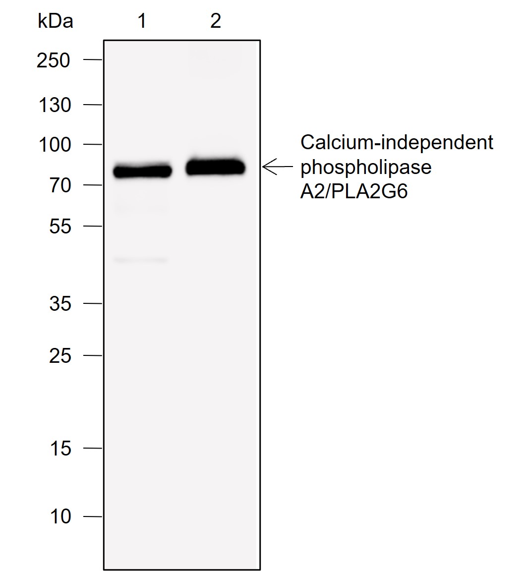Anti-PLA2G6 Rabbit mAb