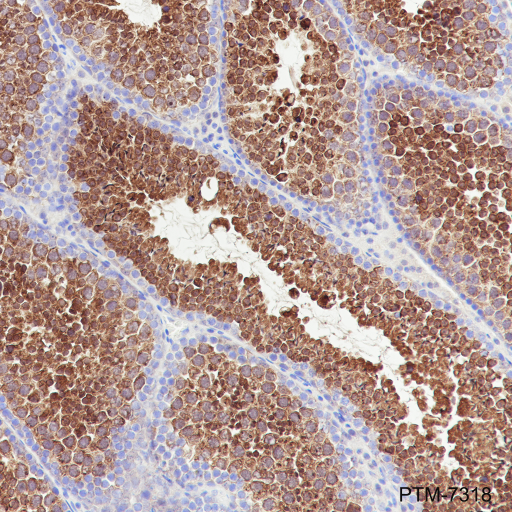 Anti-PLA2G6 Rabbit mAb