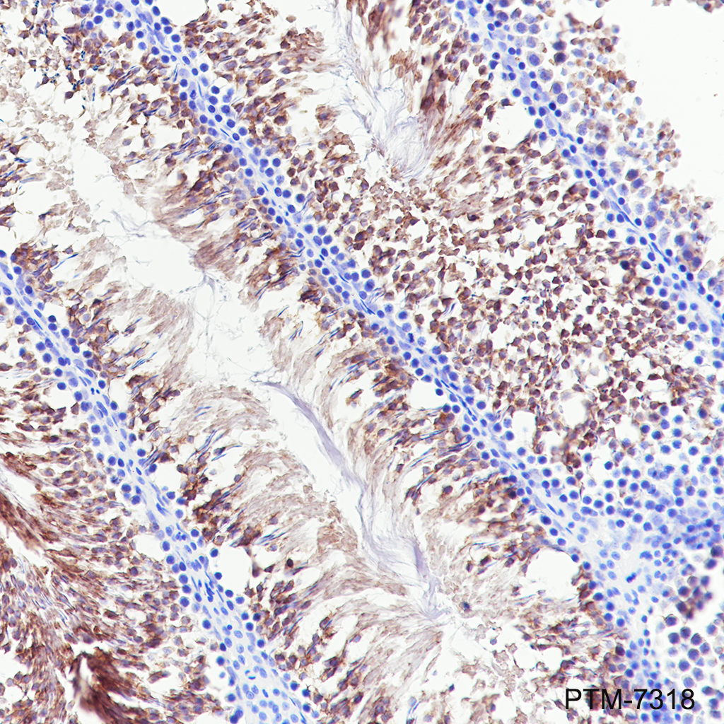Anti-PLA2G6 Rabbit mAb