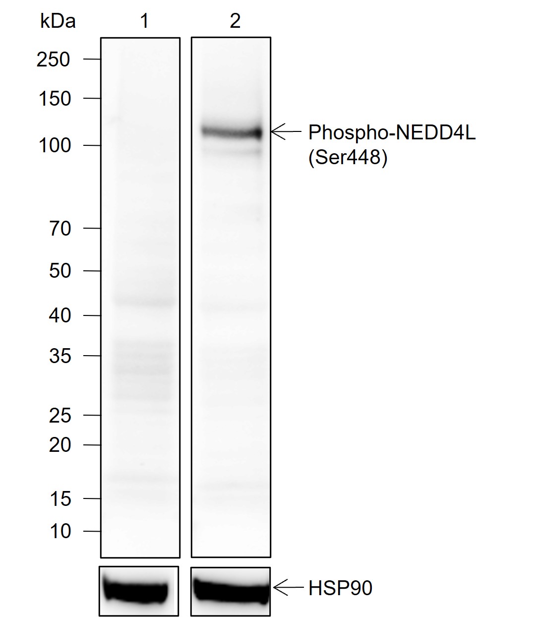Anti-Phospho-NEDD4L (Ser448) Rabbit mAb