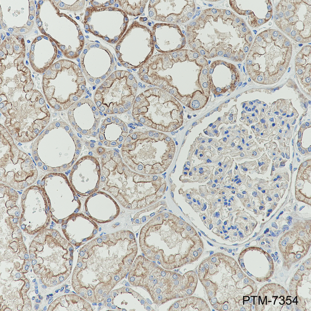Anti-TRADD Mouse mAb
