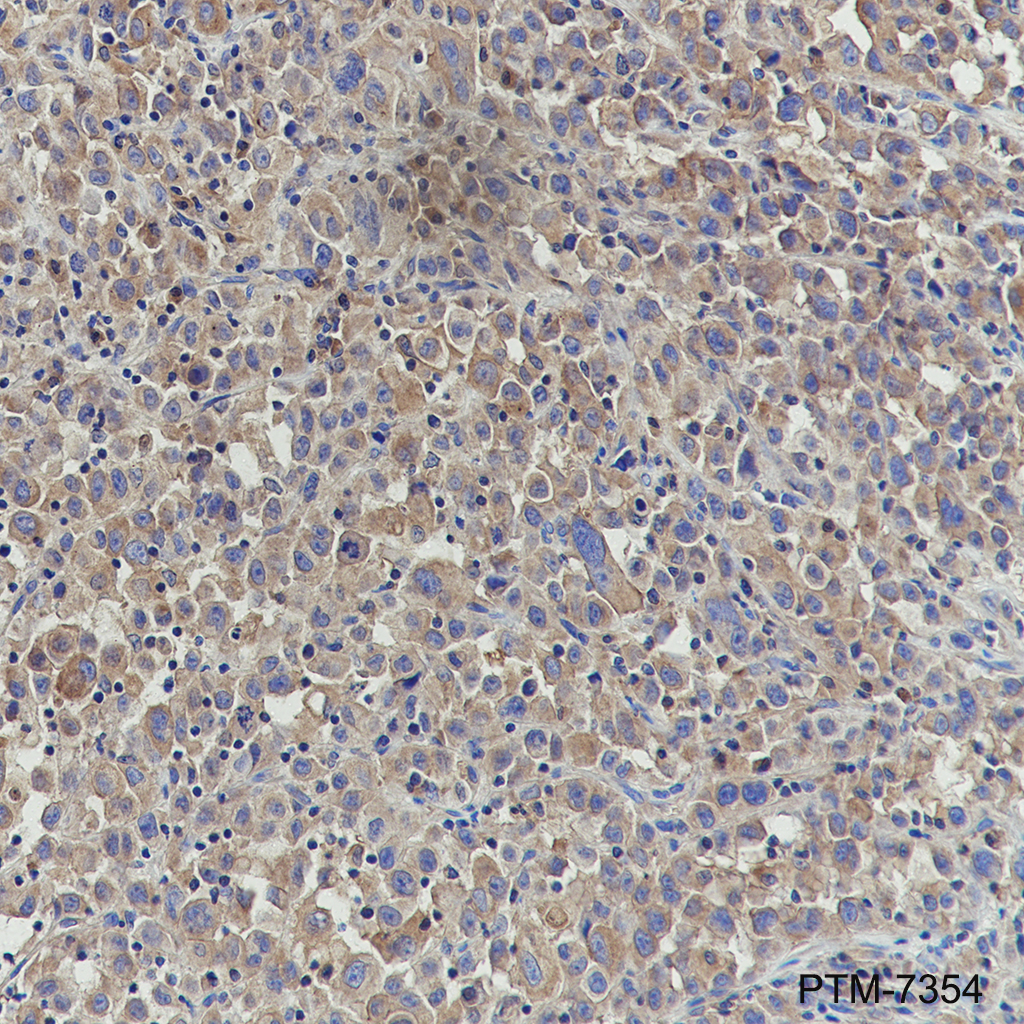 Anti-TRADD Mouse mAb