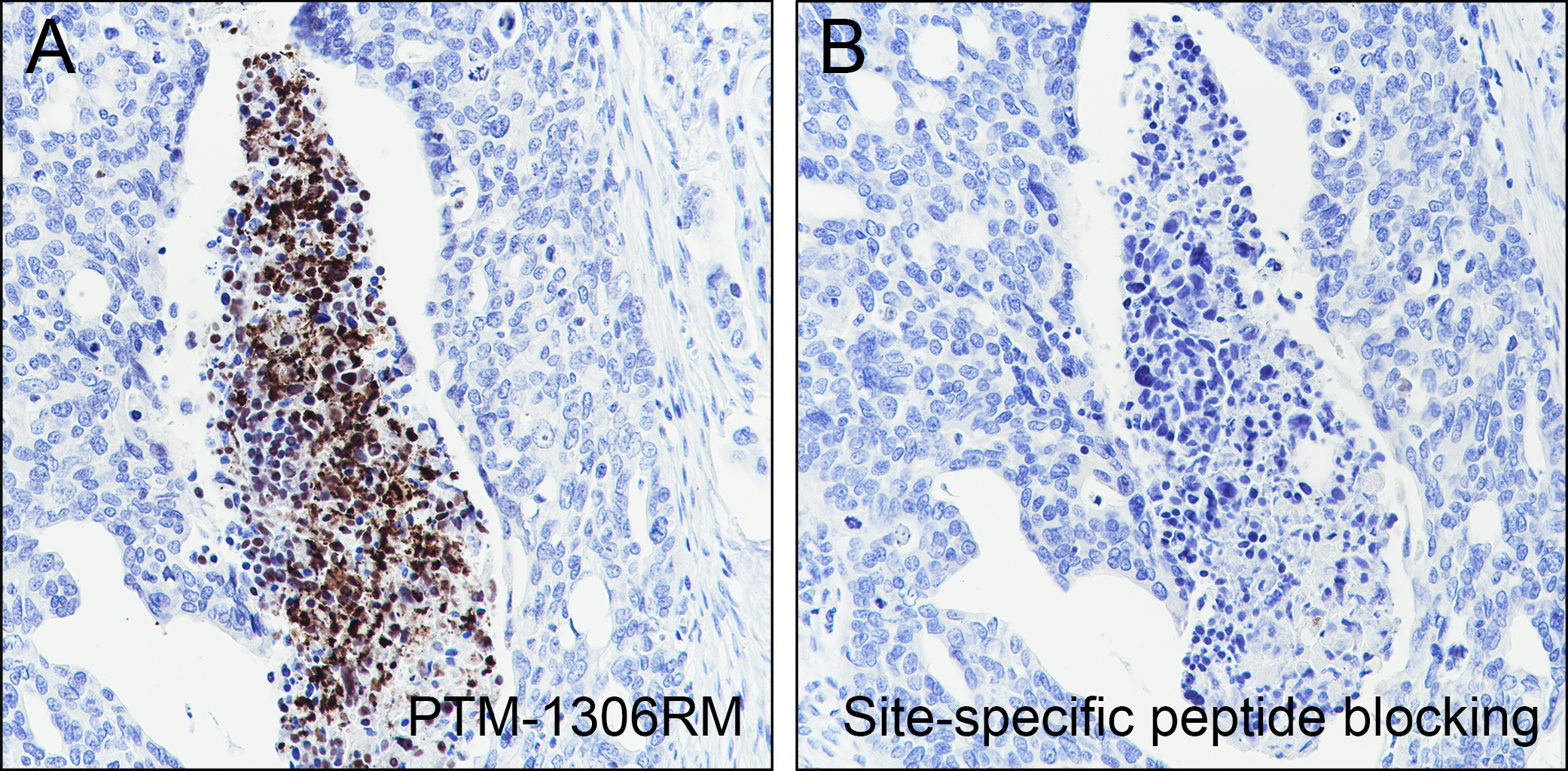 Anti-Citrulline-Histone H3 (Arg2/8/17) Rabbit mAb