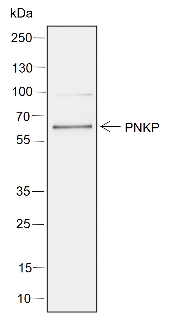 Anti-PNKP Rabbit mAb