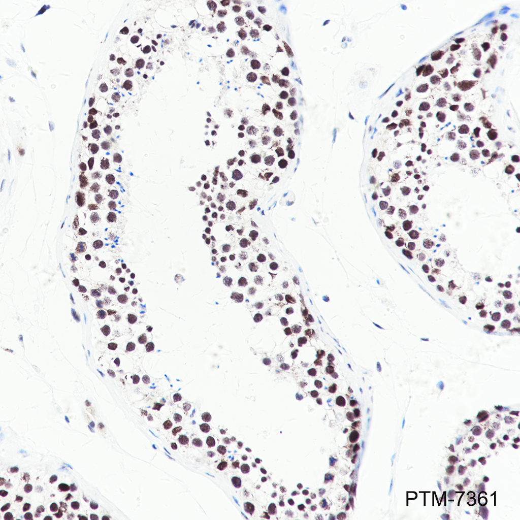 Anti-PNKP Rabbit mAb