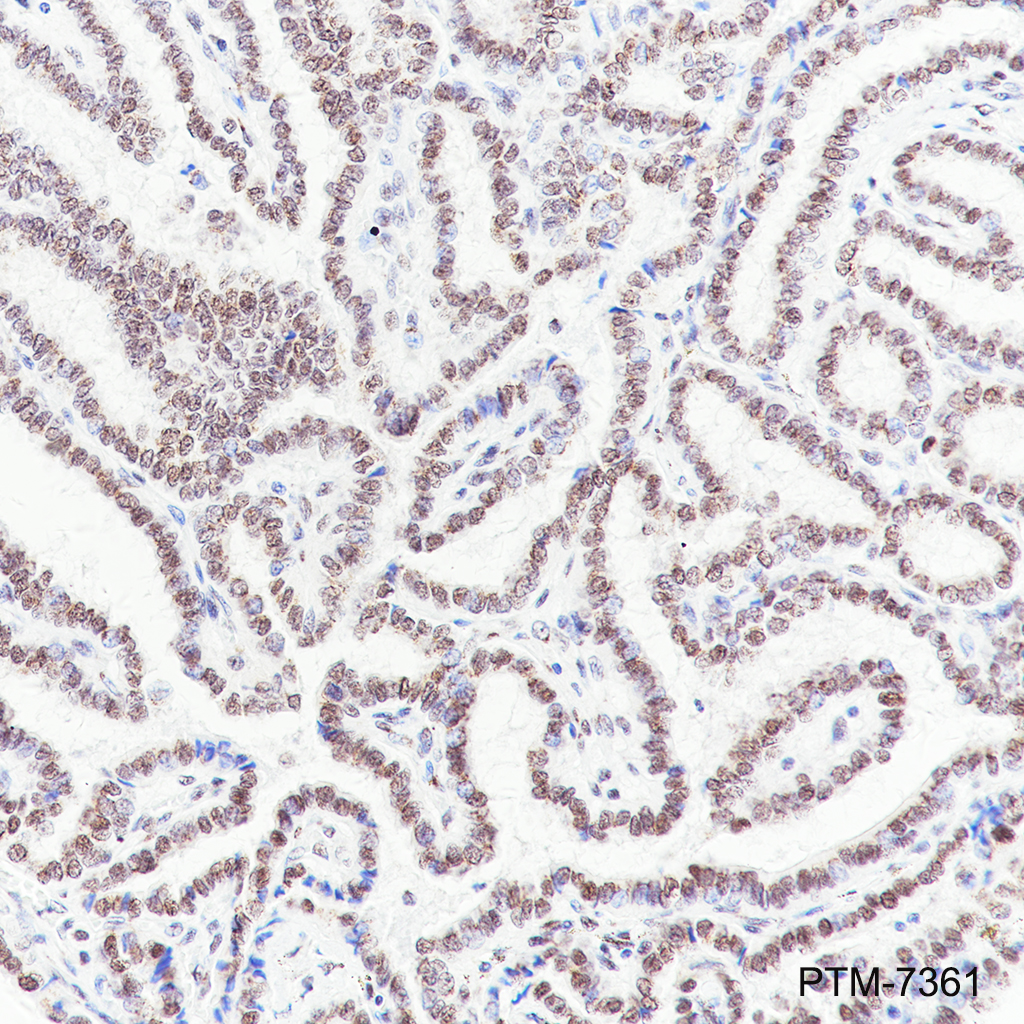 Anti-PNKP Rabbit mAb