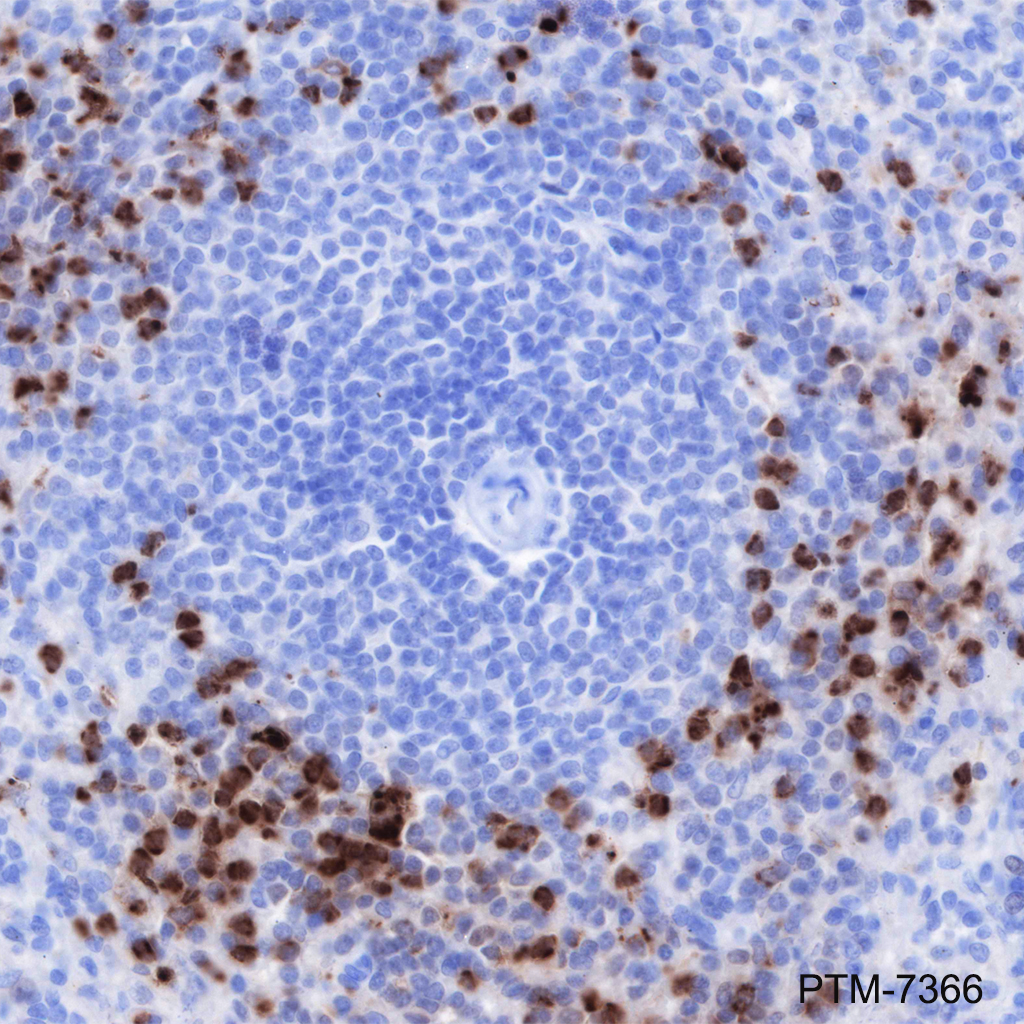 Anti-CEACAM6 Rabbit mAb