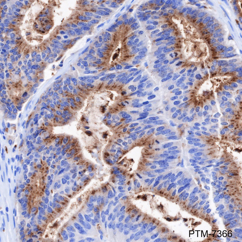 Anti-CEACAM6 Rabbit mAb