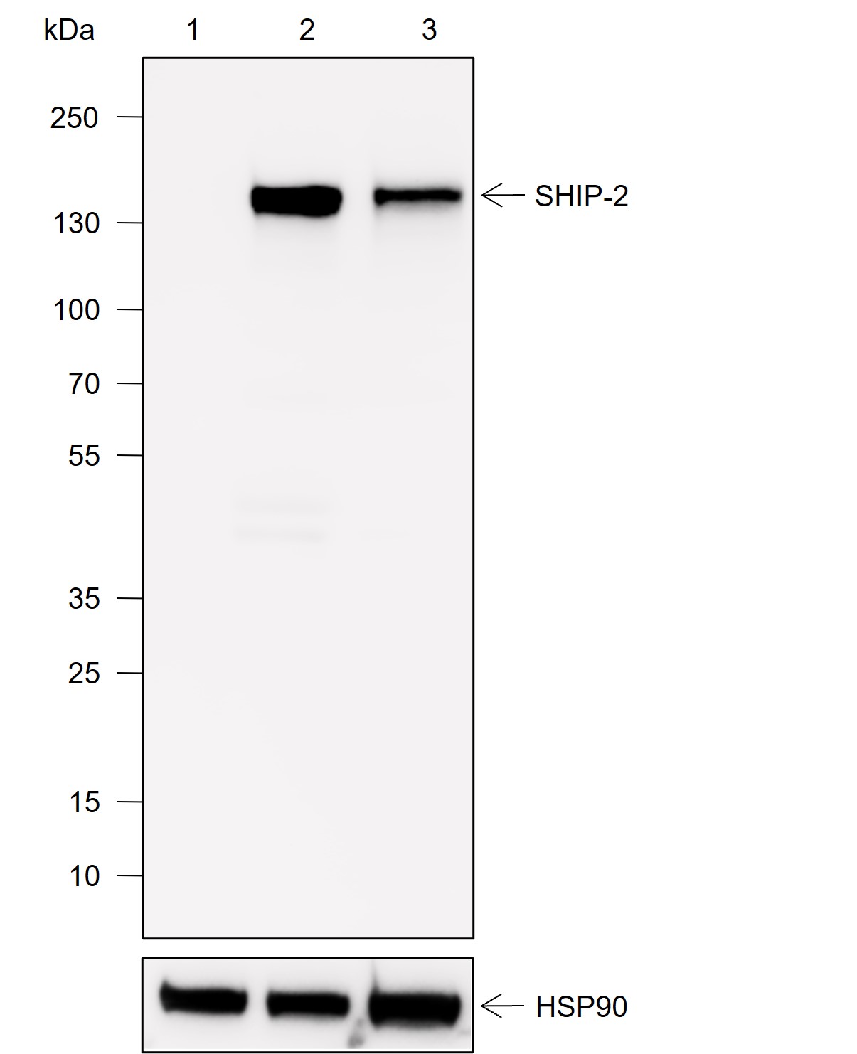 Anti-SHIP-2 Rabbit mAb