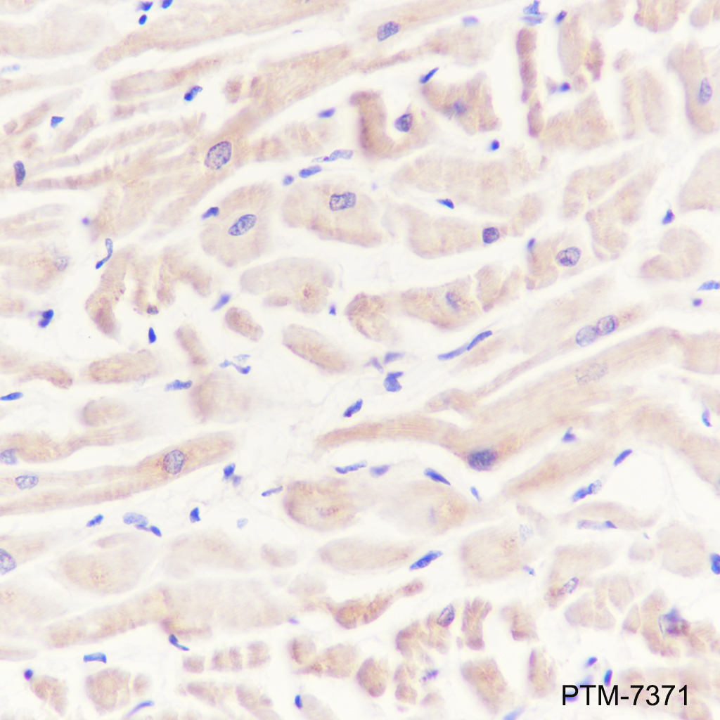 Anti-SHIP-2 Rabbit mAb