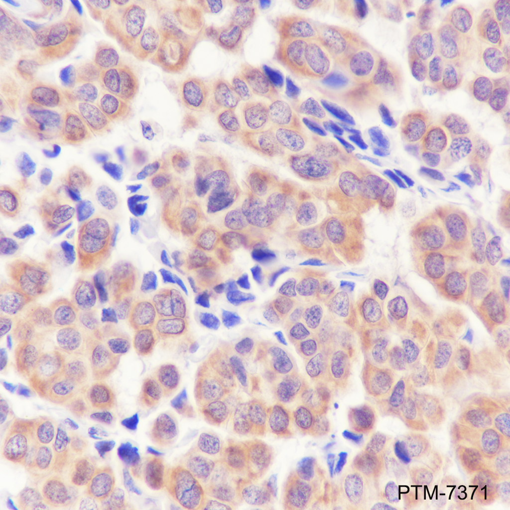 Anti-SHIP-2 Rabbit mAb