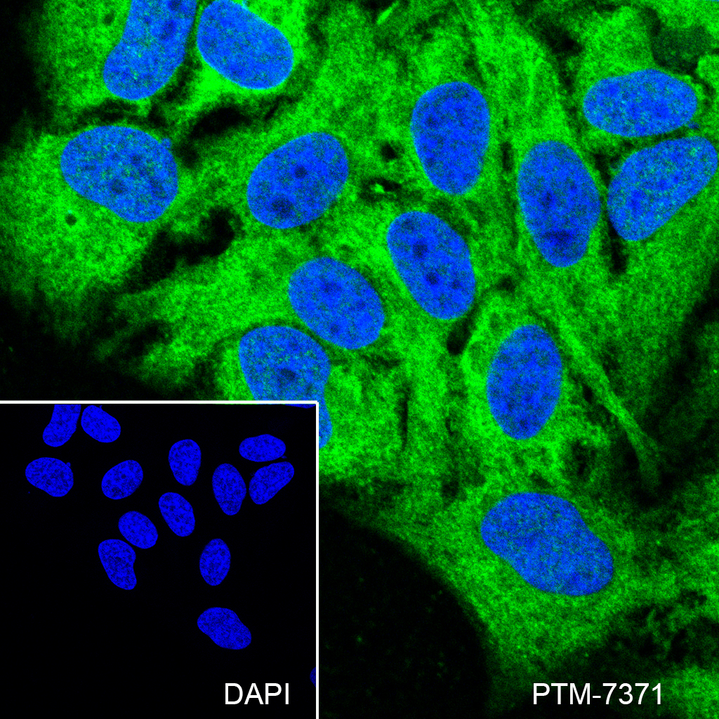Anti-SHIP-2 Rabbit mAb