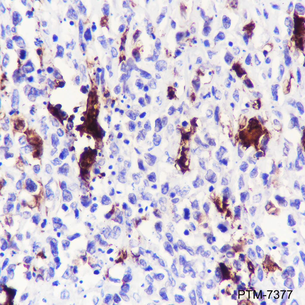 Anti-Mer Rabbit mAb
