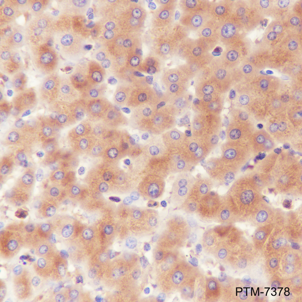 Anti-alpha 1 Acid Glycoprotein Mouse mAb