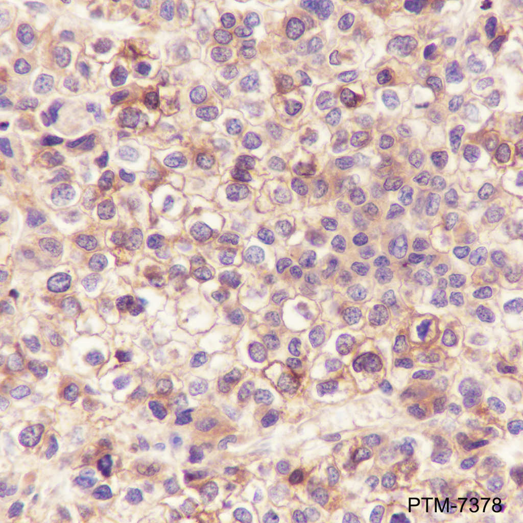 Anti-alpha 1 Acid Glycoprotein Mouse mAb