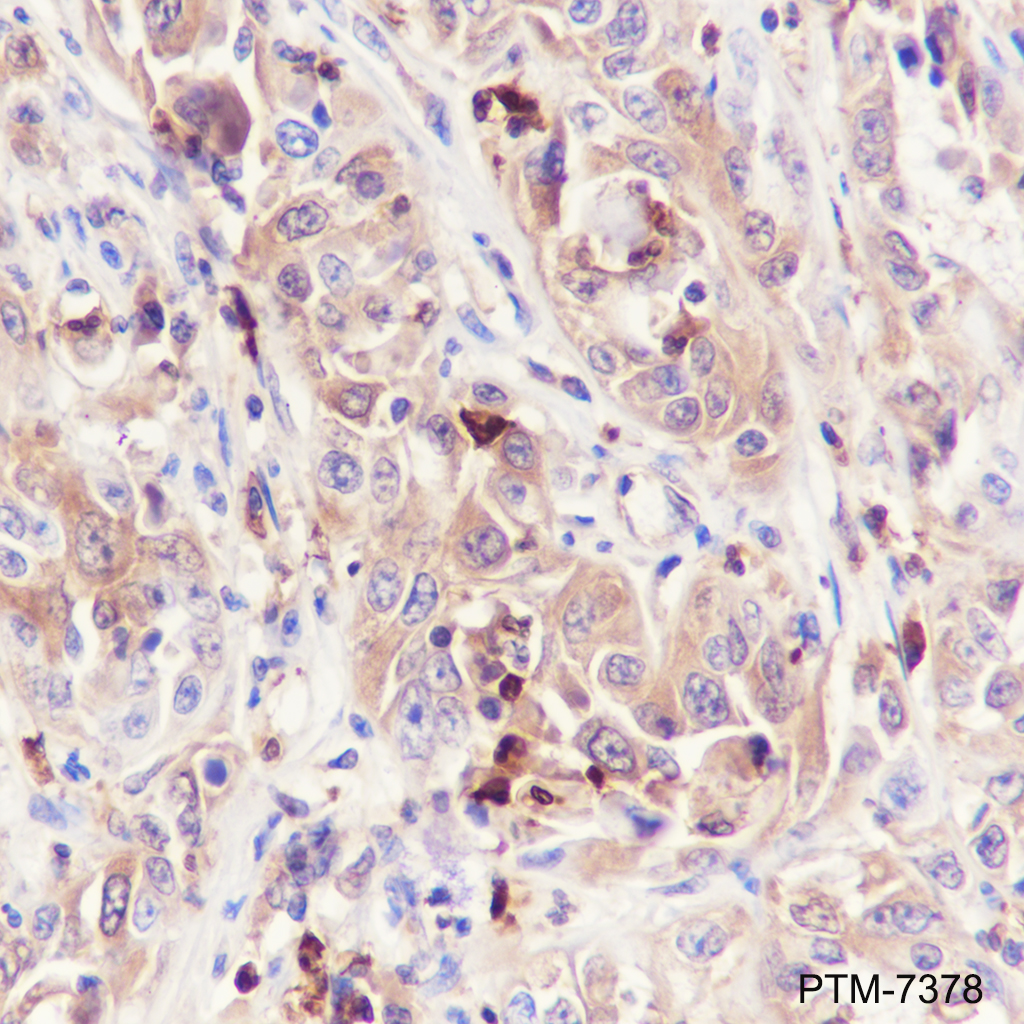 Anti-alpha 1 Acid Glycoprotein Mouse mAb