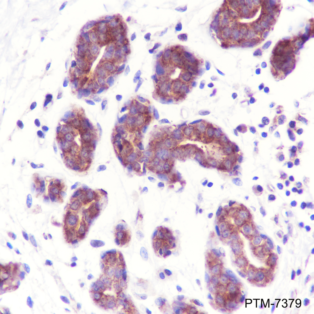 Anti-IMPDH2 Mouse mAb