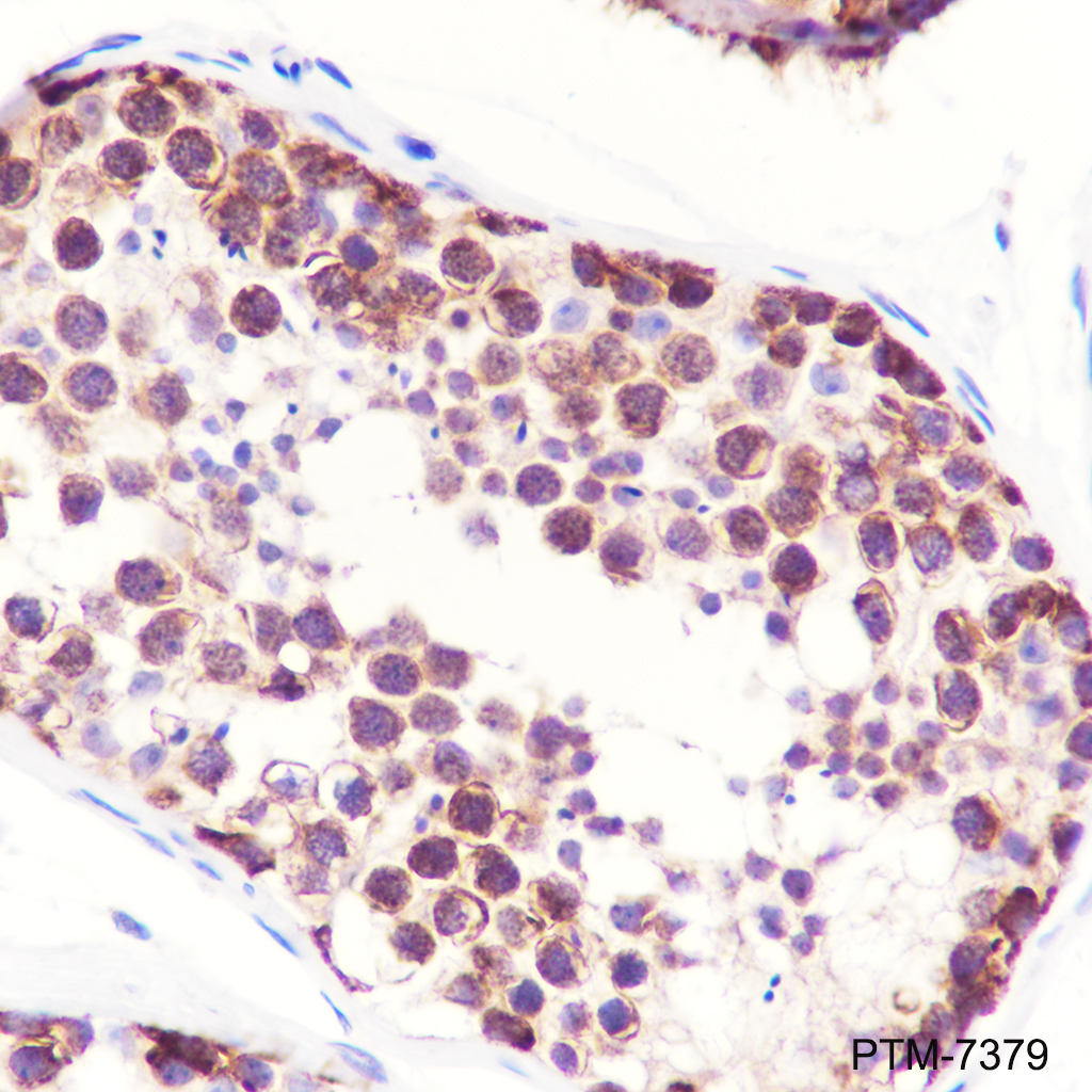 Anti-IMPDH2 Mouse mAb