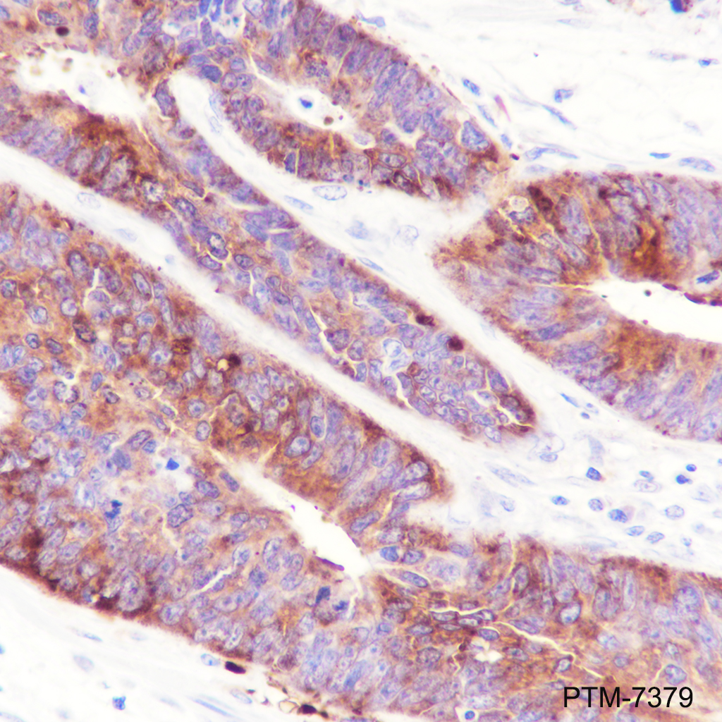 Anti-IMPDH2 Mouse mAb