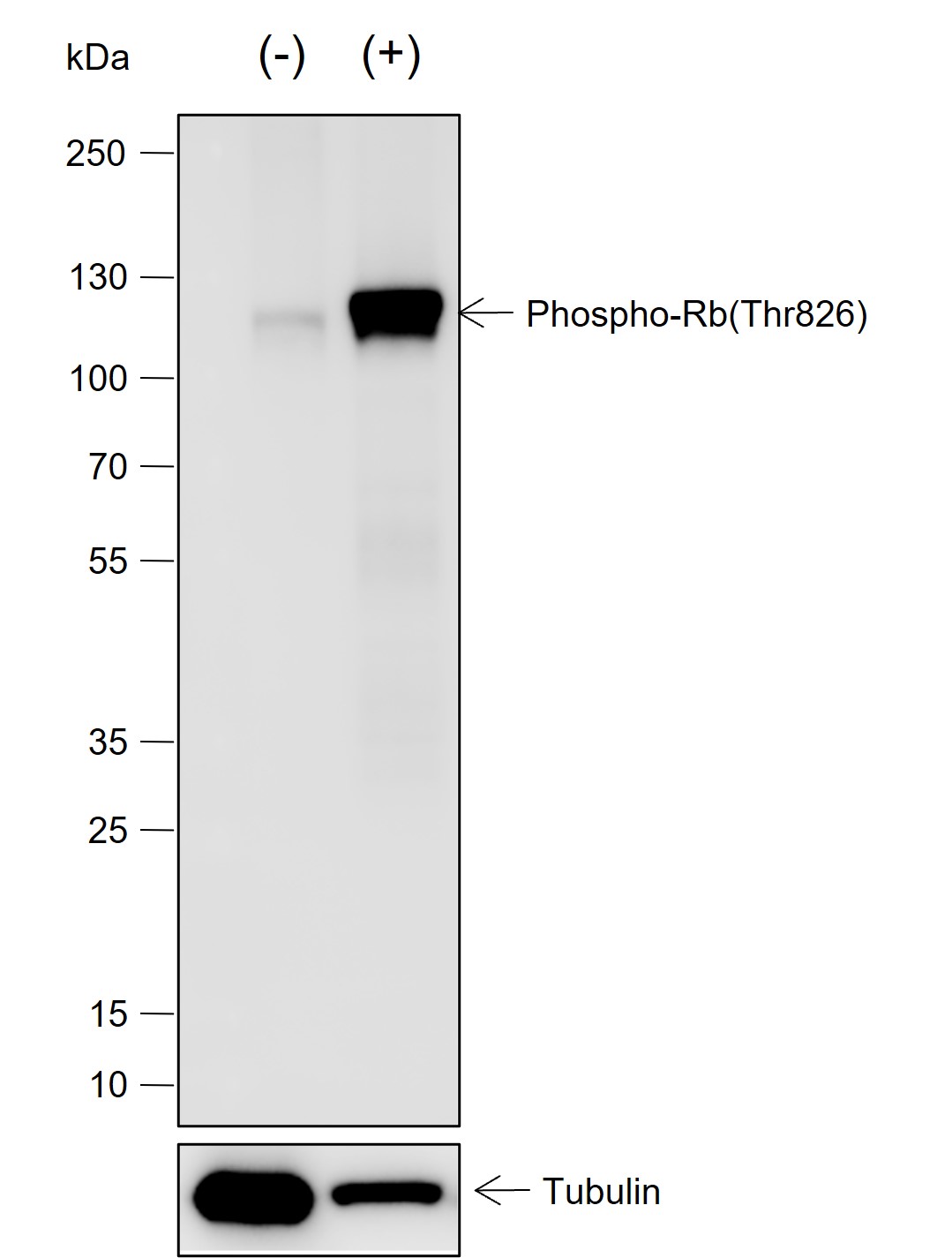 Anti-Phospho-Rb (Thr826) Rabbit mAb